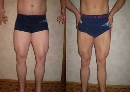 před a po keto dietě