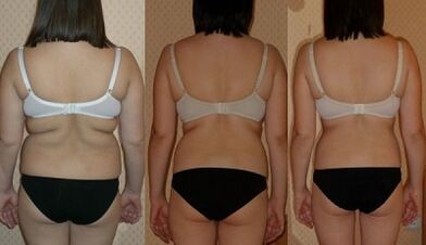 způsoby, jak zhubnout 7 kg za týden